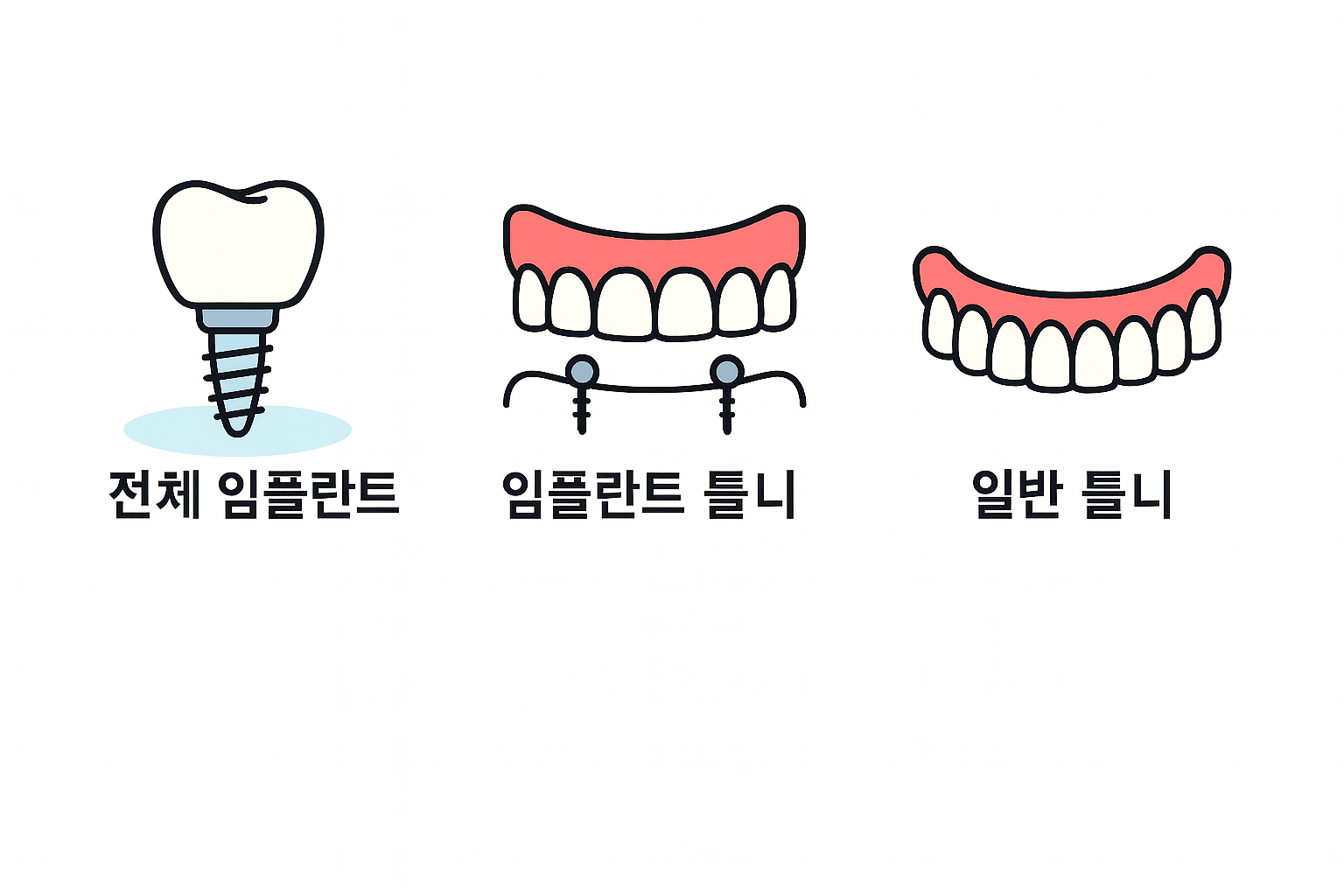 전체 임플란트 vs 임플란트 틀니 vs 일반 틀니 – 어떤 게 더 경제적일까?